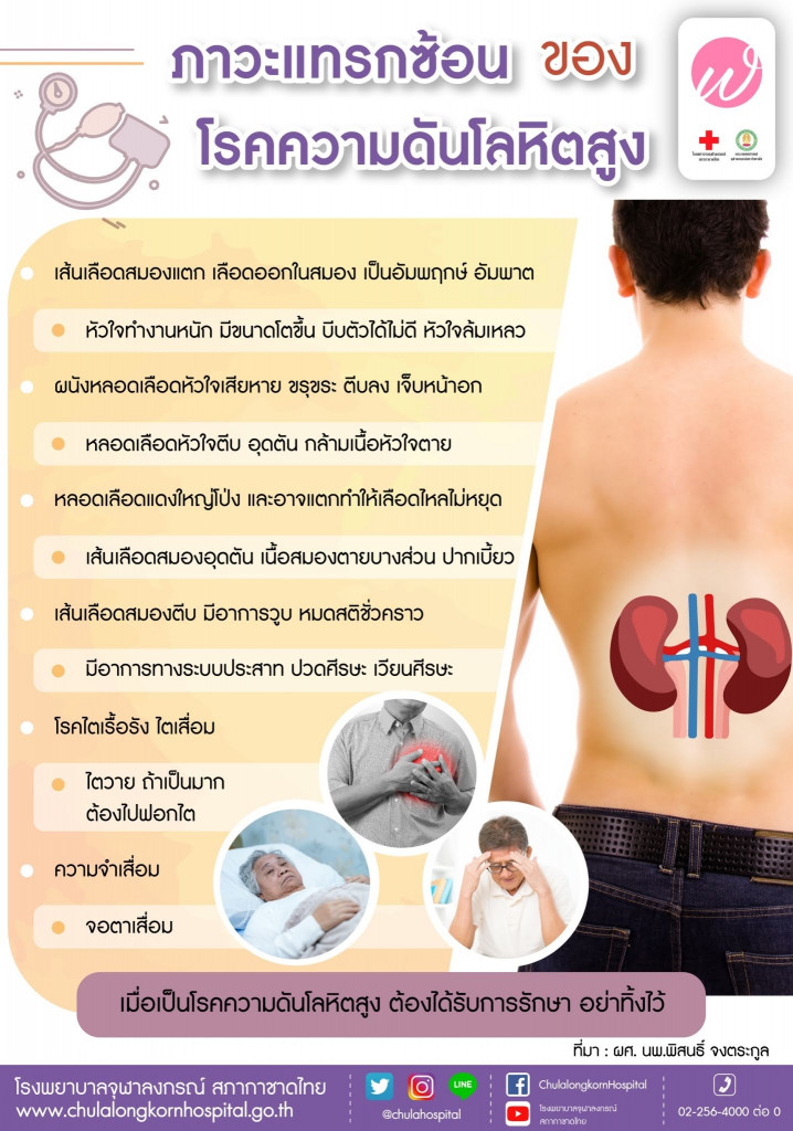 09 ภาวะแทรกซ้อนของโรคความดันโลหิตสูง Line Chulahospital Aug'19