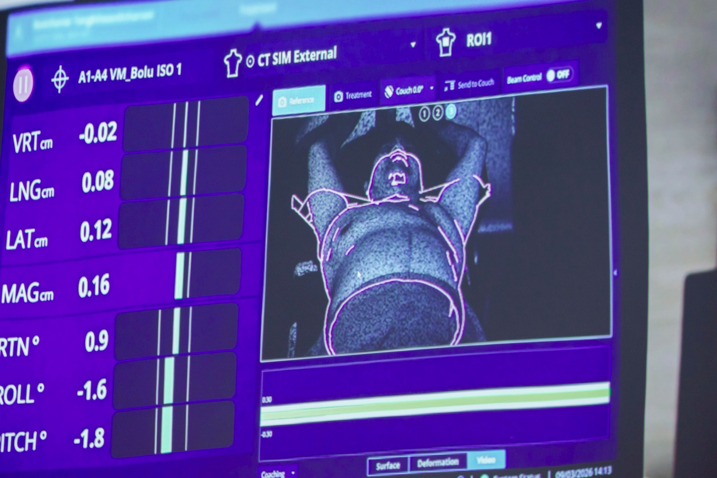 LINE_ALBUM_จุดฉายแสงแทนขีดเส้น_260331_16