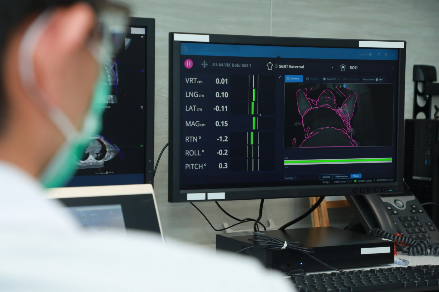 LINE_ALBUM_จุดฉายแสงแทนขีดเส้น_260331_5